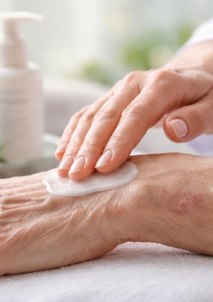 Soins spécialisés pour la dermatoporose : renforcer la peau fine et fragile